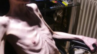 anorexic Denisa 8t00184