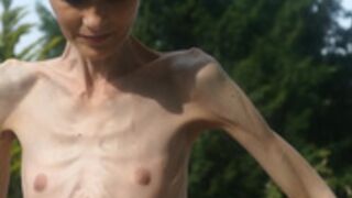 anorexic Denisa 8t00204