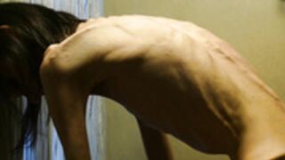 anorexic Denisa 8t00204