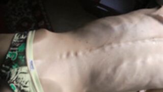 anorexic Denisa 8t00560