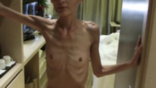 anorexic Denisa 8t00548