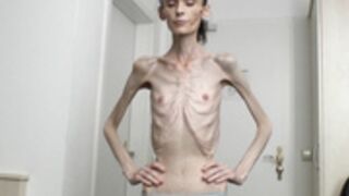 anorexic Denisa 8t00228