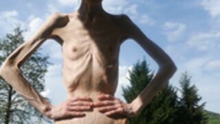 anorexic Denisa 8t00208