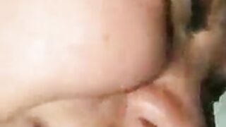 hard anal pain 2