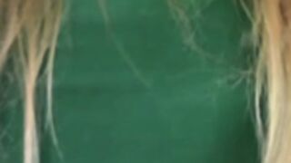 Koa breast expansion 2