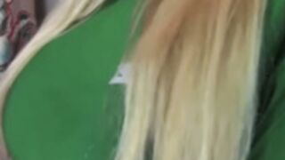 Koa breast expansion 2