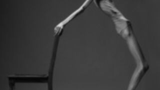 skin and bones