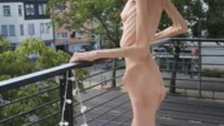 skin and bones