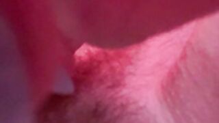 Ernaburn pussy 2