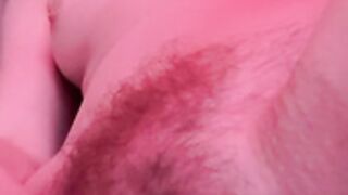 Ernaburn pussy 2