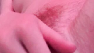 Ernaburn pussy 2