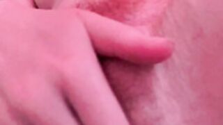 Ernaburn pussy 2