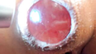 Fucking her prolapse