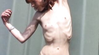anorexic Ilka flexing 1