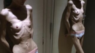 anorexic Denisa e5B1x