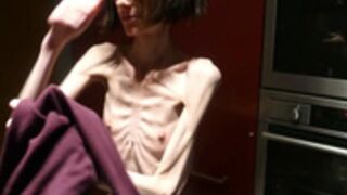 anorexic Denisa 30-03-2020