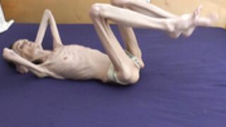 anorexic Denisa 28-12-2020