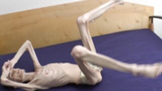 anorexic Denisa 28-12-2020