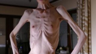 anorexic Denisa 19-08-2019
