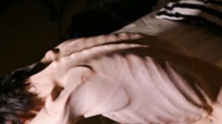 anorexic Denisa 19-08-2019