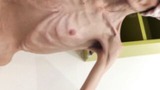 anorexic Denisa 16-05-2022