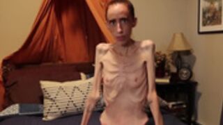 anorexic Muse J 19-09-2022