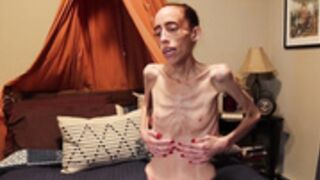 anorexic Muse J 19-09-2022