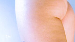 Bastet's DSLR Camera allows 4 detailed skin examination