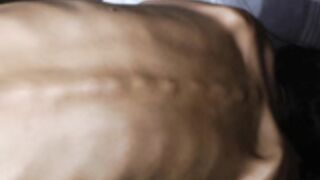 anorexic Nicoleta L2s8d