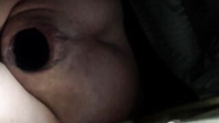 gynecological examination after a rape