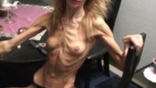 anorexic Inna (2)