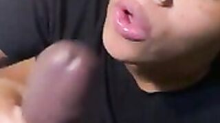 T Pocahontas draining a BBC facial end