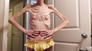 anorexic MuseJ 06-02-2023 8t00788 oil