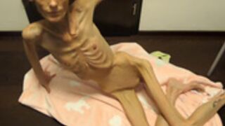 anorexic Denisa 02-05-2022 8t00744