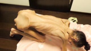 anorexic Denisa 02-05-2022 8t00744