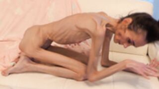 anorexic Denisa 02-05-2022 8t00744