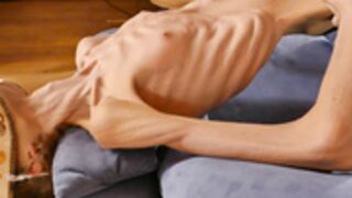 anorexic Venice 28-11-2022 8t00774