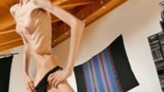 anorexic Venice 28-11-2022 8t00774