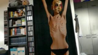 anorexic Venice 30-01-2023 8t00786