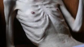 anorexic Denisa 20-03-2023 8t00799