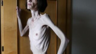 anorexic Denisa 20-03-2023 8t00799
