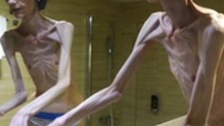 anorexic Denisa 06-02-2023 8t00787