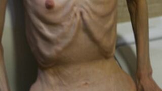 anorexic Denisa 06-02-2023 8t00787