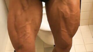 fbb veins