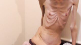 anorexic Denisa 05-12-2022 8t00775