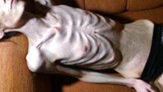 anorexic Denisa 06-03-2023 8t00795