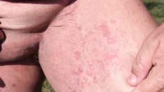 Allergie entre les jambes, Noel Lauffenburger