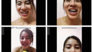 Thai asian brace cute girl sexy body fully nude smile