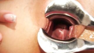 loveskelly schoolgirl speculum pussy