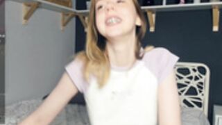 Kesi braces teeth KASSANDRACRUZ, KIRAGAVES, 18 teen